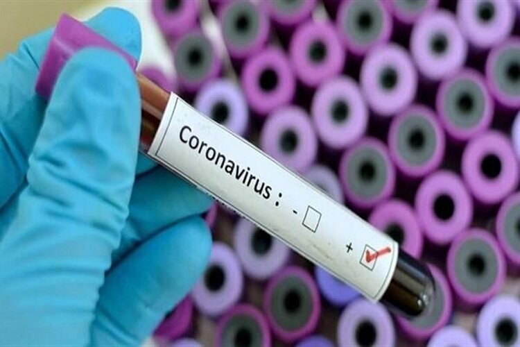 فهرست جدید آزمایشگاههای مجاز تشخیص کرونا اعلام شد فهرست جدید آزمایشگاههای مجاز تشخیص کرونا اعلام شد