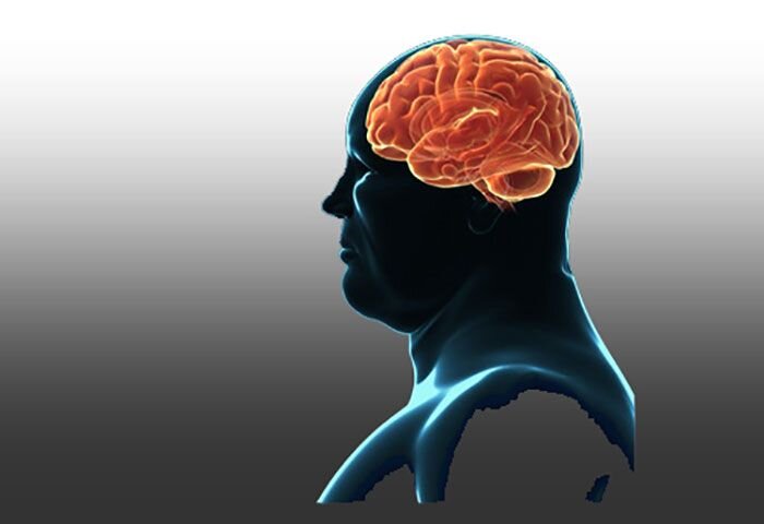 چاقی مغز را تغییر می‌دهد| تغییرات مغزی علت مشکل بودن کم کردن وزن است