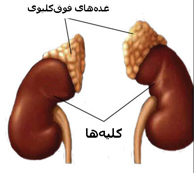 یک‌علت فشار خون بالا که معمولا پزشکان  نادیده می‌گیرند