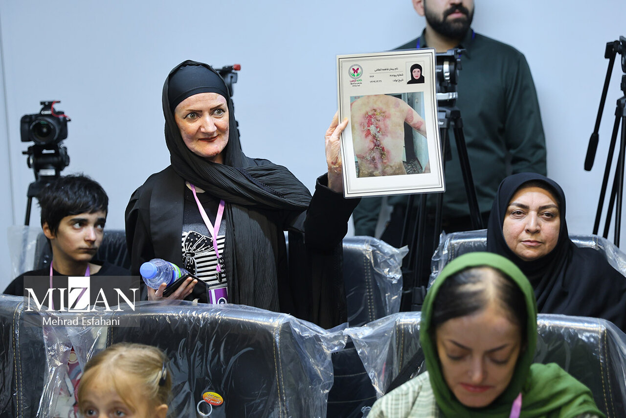 واریز غرامت به حساب ۶۳۲ بیمار پروانه‌ای؛ ۱۳۹ پرونده همچنان در حال پیگیری